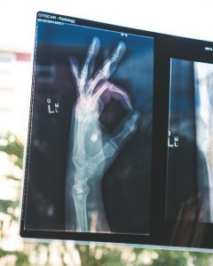 hand on a scan